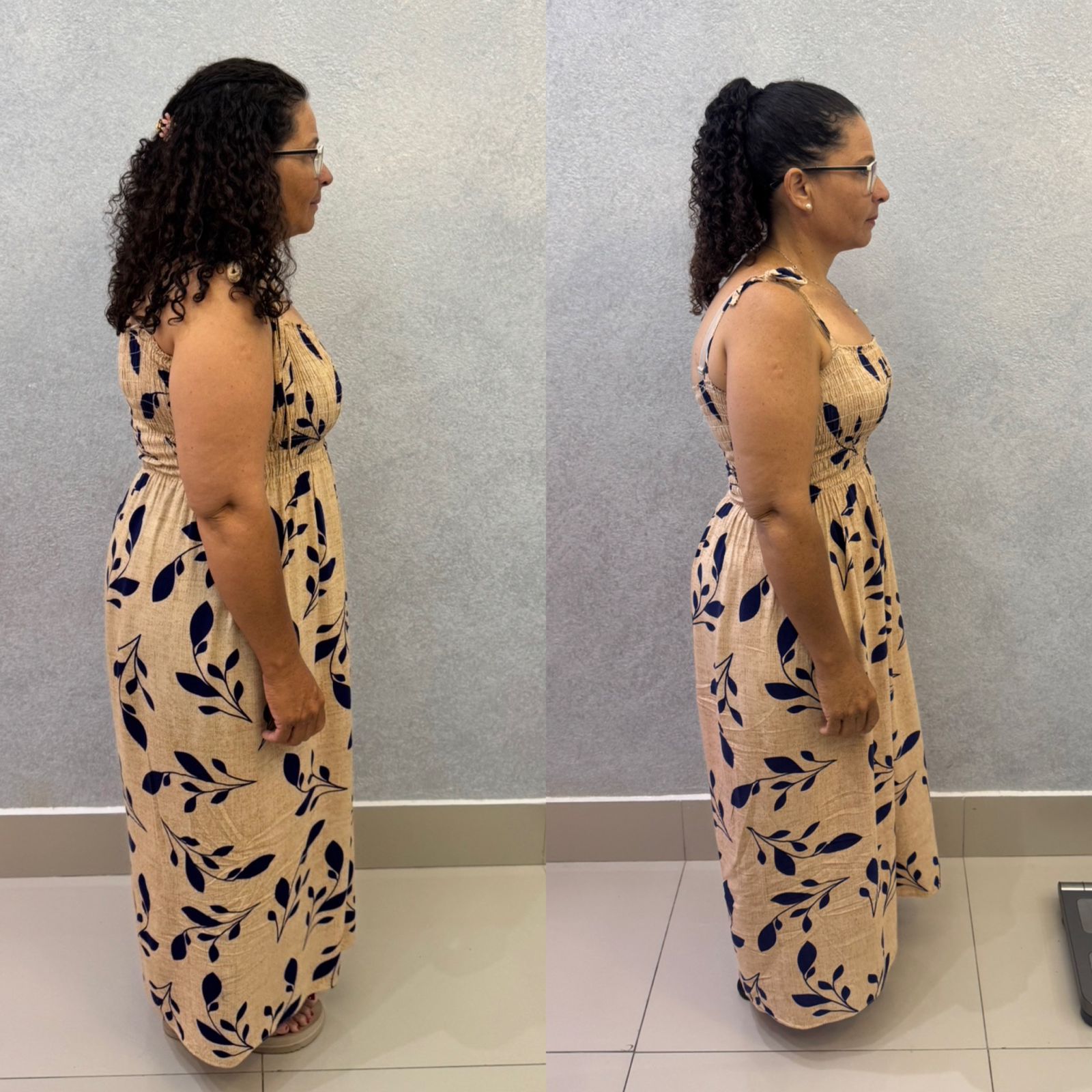 Resultado Antes e Depois